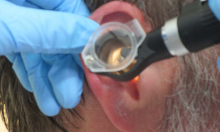 Ear Care: Assessment and Irrigation